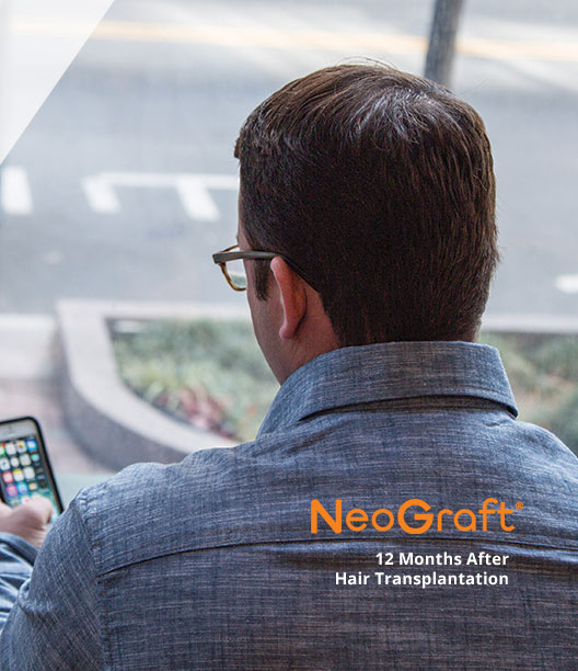 Neograft-Hair-Transplants-Raleigh-NC Koher Neograft FUE hair transplant Jernigans Raleigh NC